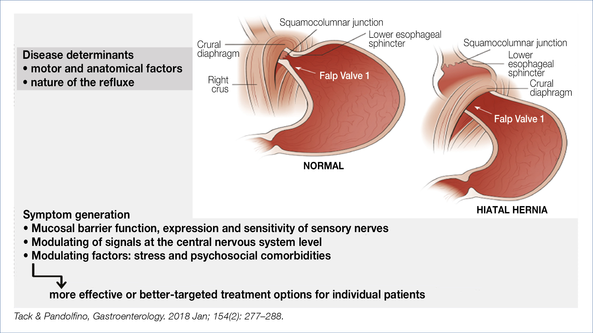 Esophageal Infusion of Menthol Does Not Affect Esophageal Motility