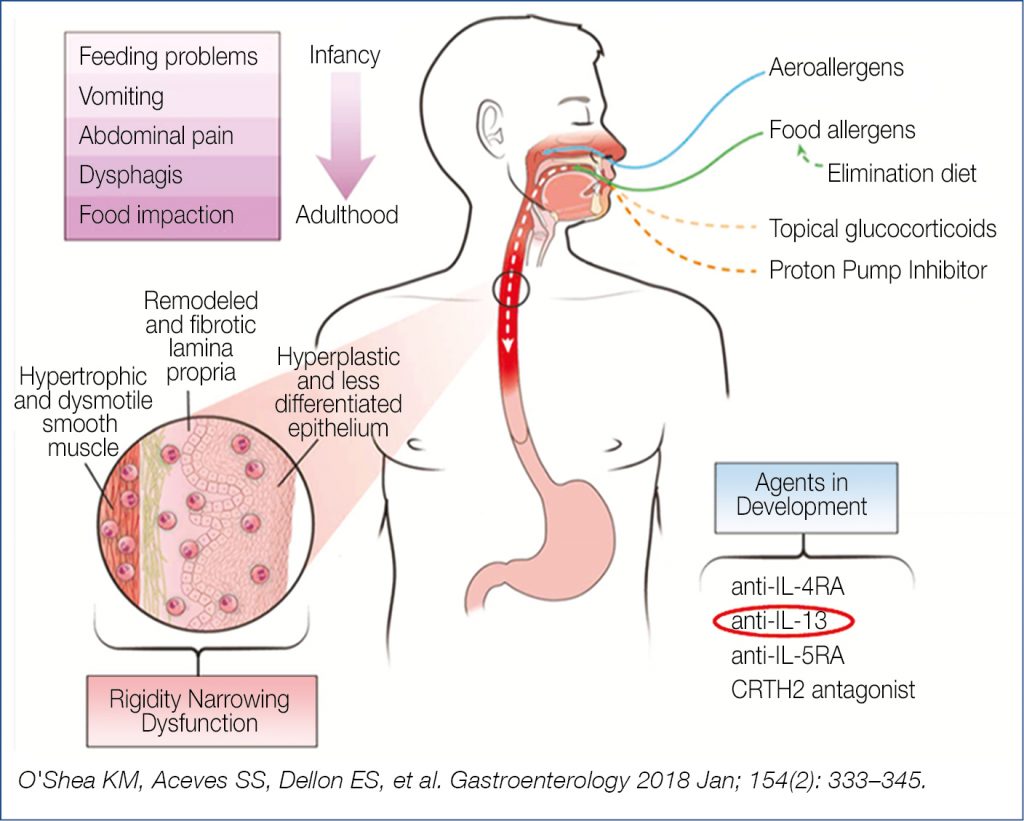 A) The infusion of menthol into the esophagus evokes almost